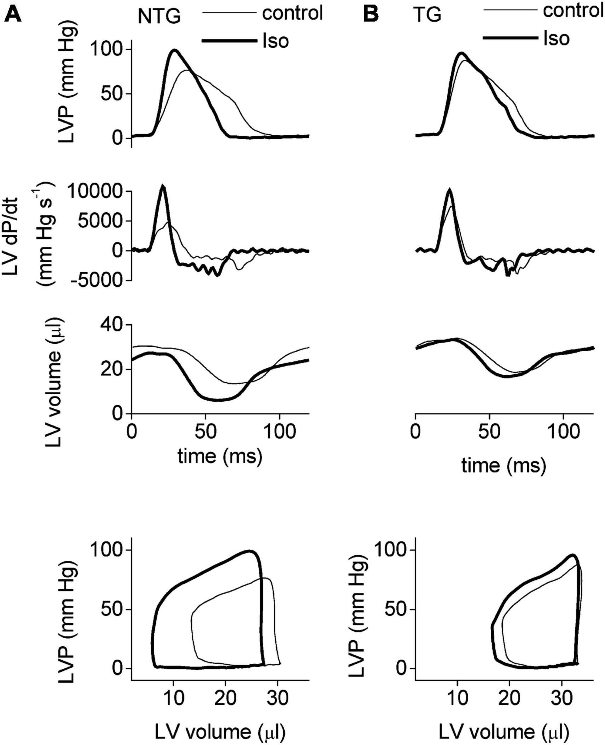 Suppression of lusitropy as a disease mechanism in cardiomyopathies